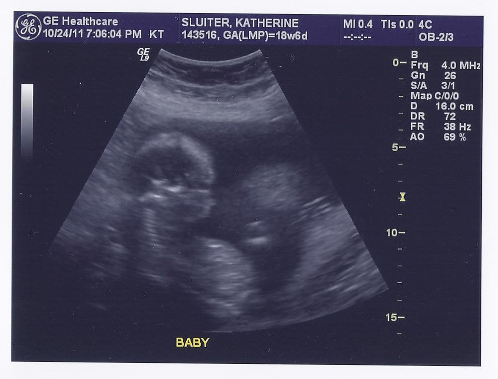 Scan0002